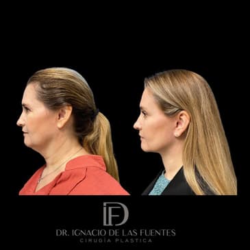 Slider image (3) Dr. Ignacio De Las Fuentes
